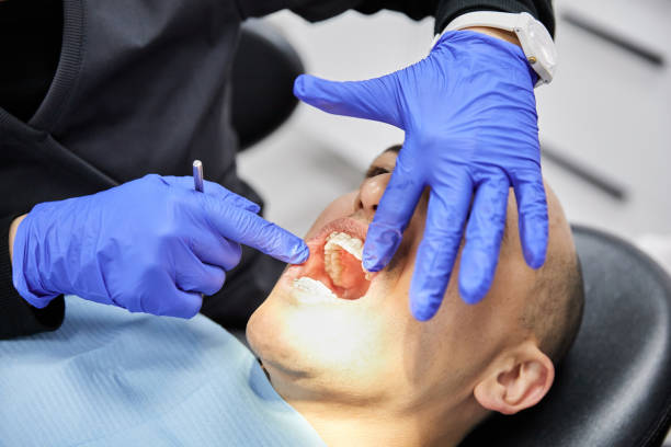 Best Urgent Tooth Repair  in Austintown, OH